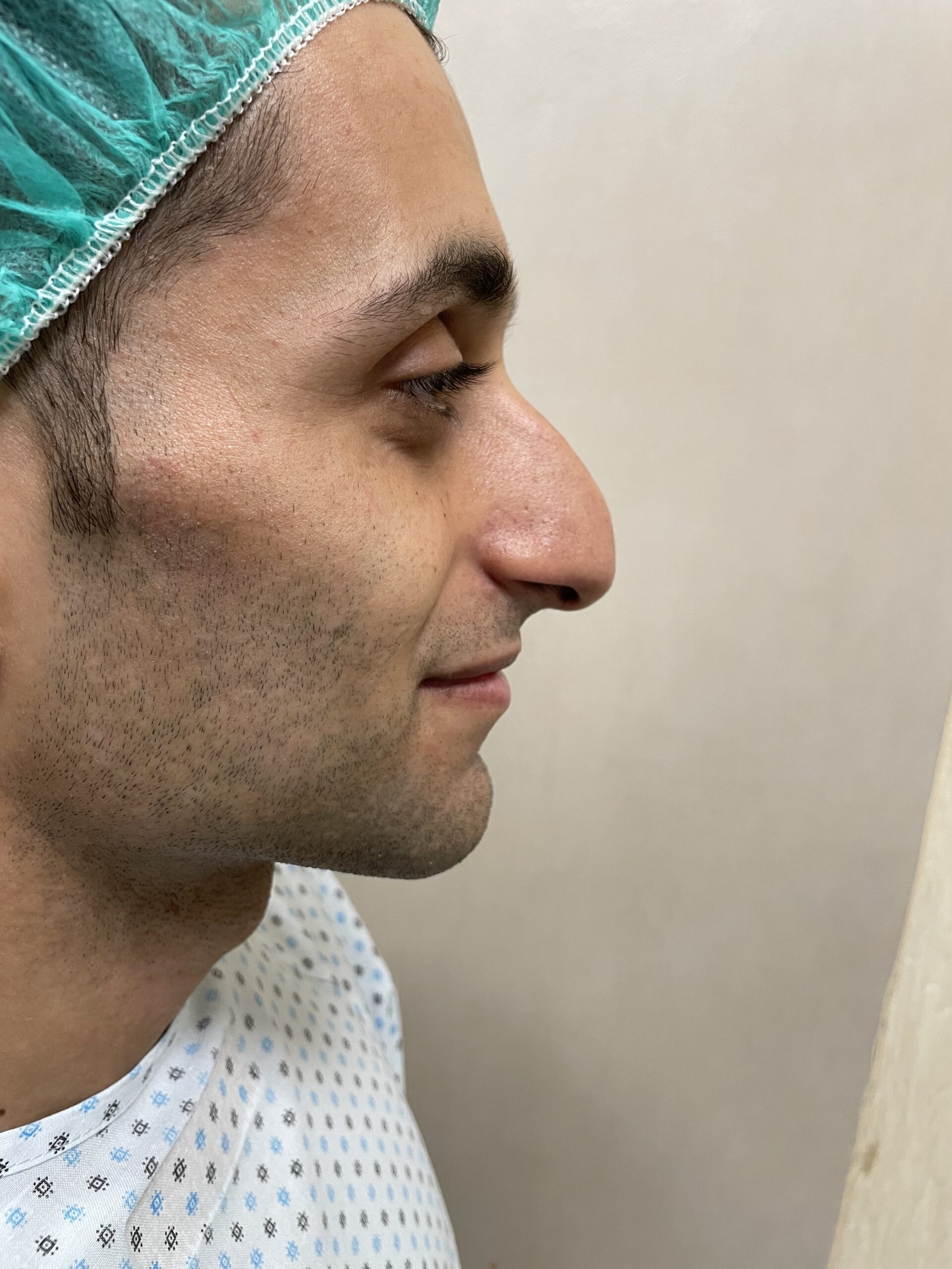 IMG scaled - epilazione - Chirurgo plastico Catania