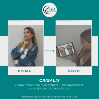 crisalix - Chirurgo plastico Catania