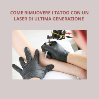 Rimuovere i tattoo dal Dottor Curreri a Catania