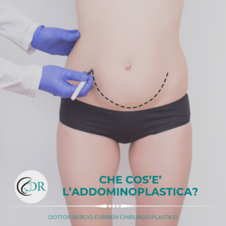 addominoplastica - Chirurgo plastico Catania