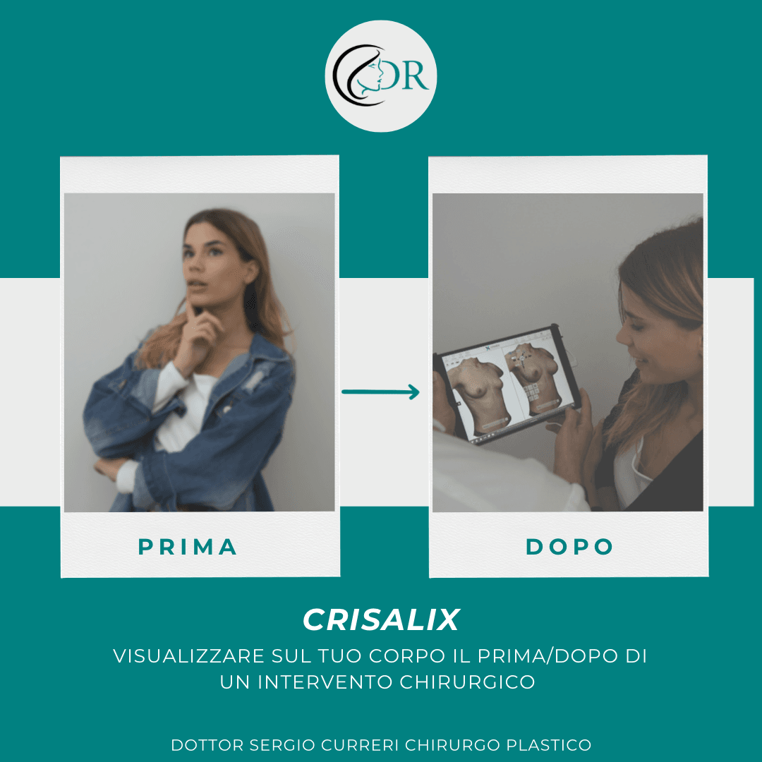Crisalix RIVOLUZIONE NELLA CHIRURGIA ESTETICA: ESPLORIAMO LA TECNOLOGIA CRISALIX